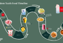 what can you eat after wisdom teeth removal
